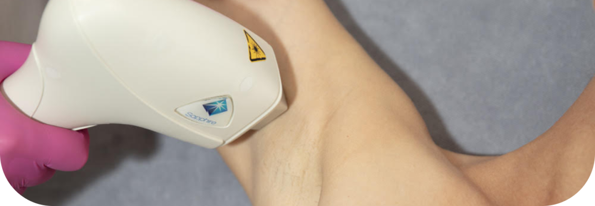 diodinis-lazeris-opphalo