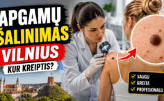 Apgamų šalinimas Vilniuje — kur kreiptis dėl konsultacijos?