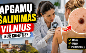 Apgamų šalinimas Vilniuje — kur kreiptis dėl konsultacijos?