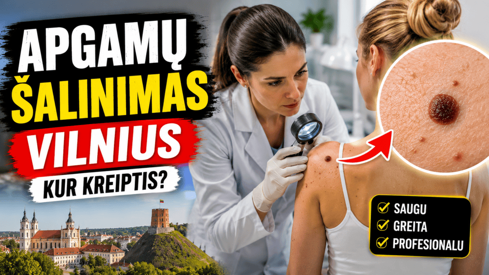 apgamu salinimas vilnius kur kreiptis del konsultacijos